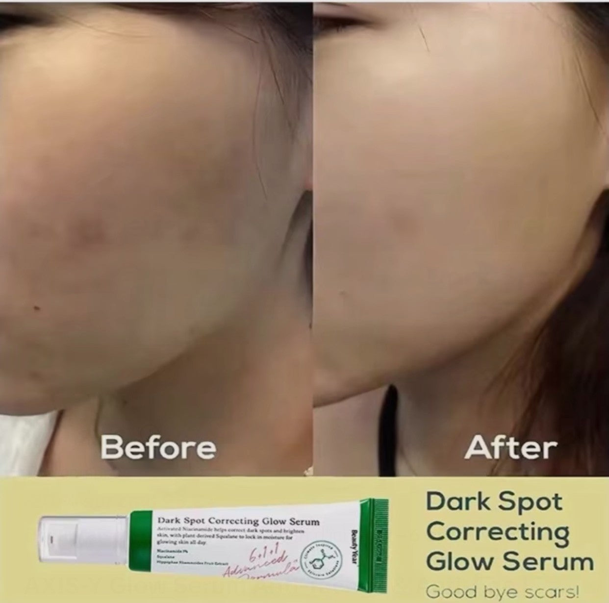 AXIS-Y Sérum Coréen Anti-Taches Dark Spot Correcting Glow Niacinamide 5 % – Vegan