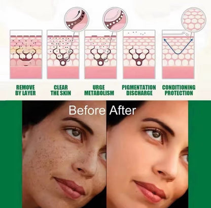 AXIS-Y Sérum Coréen Anti-Taches Dark Spot Correcting Glow Niacinamide 5 % – Vegan